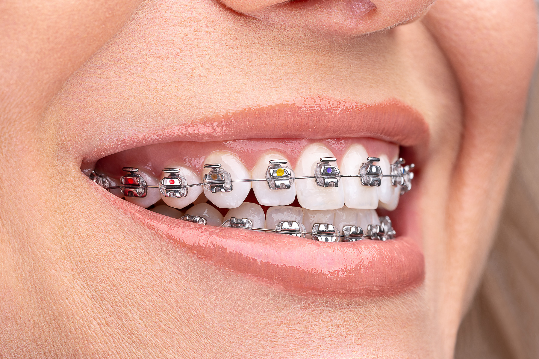 interorto©LenkaImrichova1